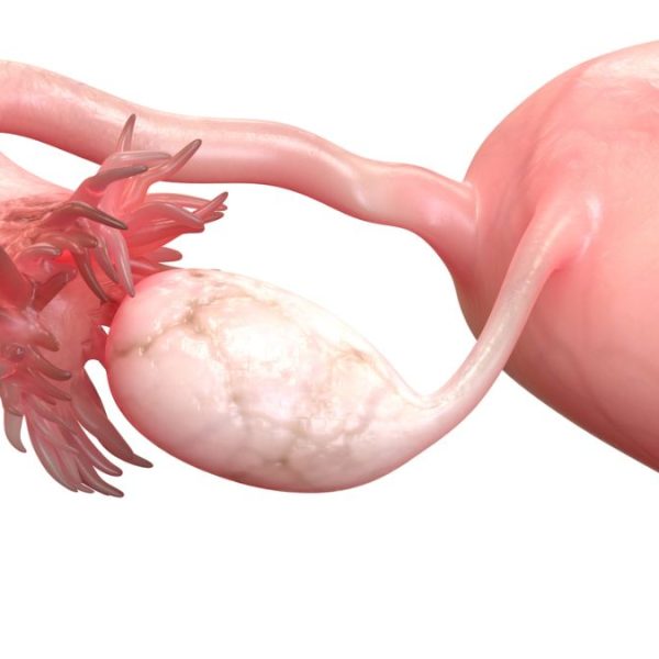 Female Reproductive System (Ovary Anatomy) - Op. Dr. Gonca Oğurlu Pakay